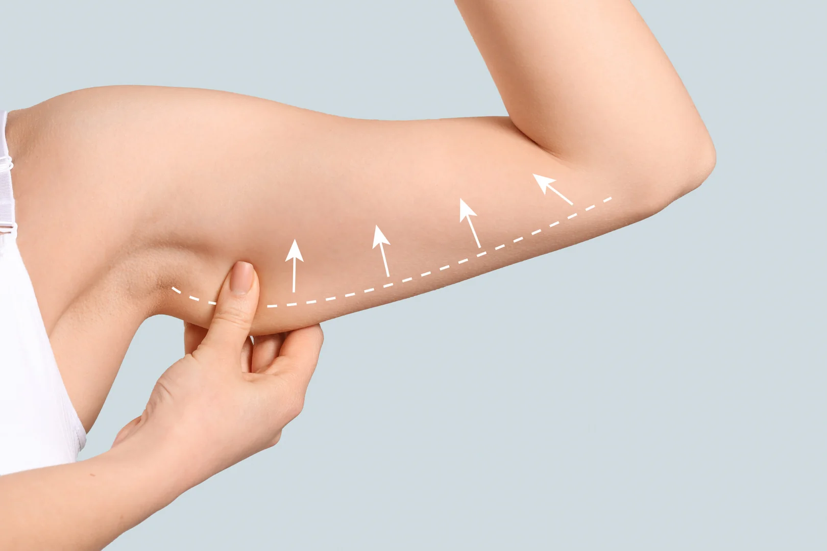 Limb & Comprehensive Body Lifts in Iran