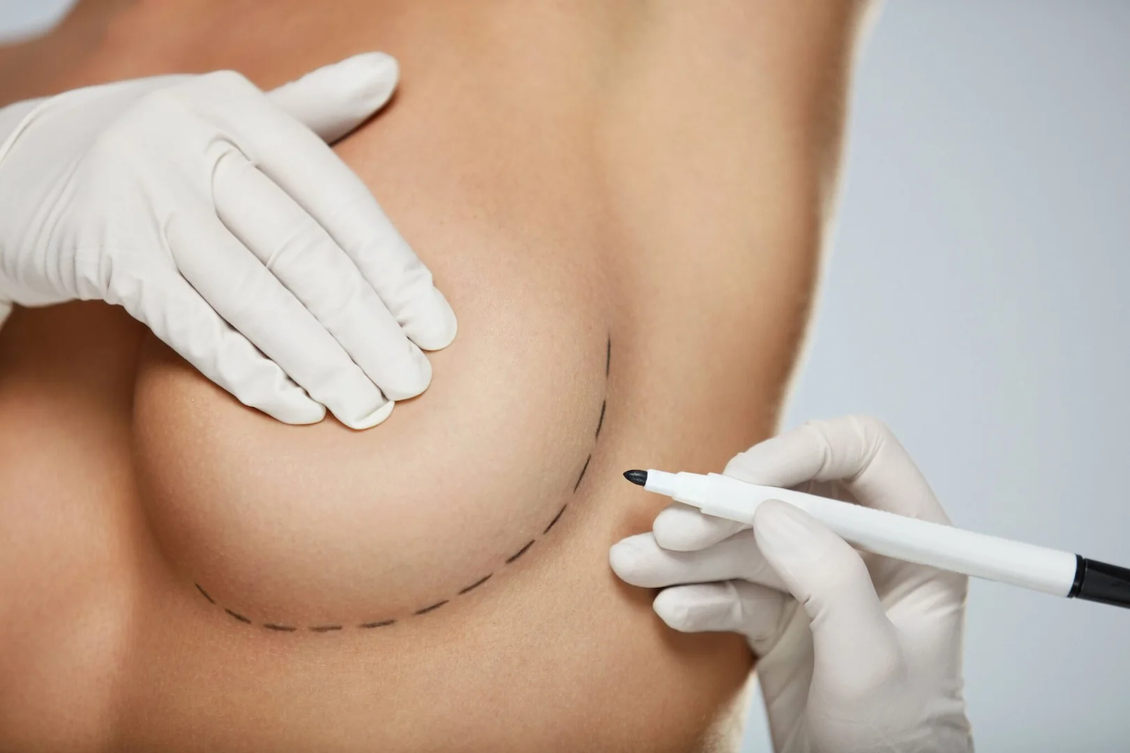 Breast & Chest Contouring in Iran