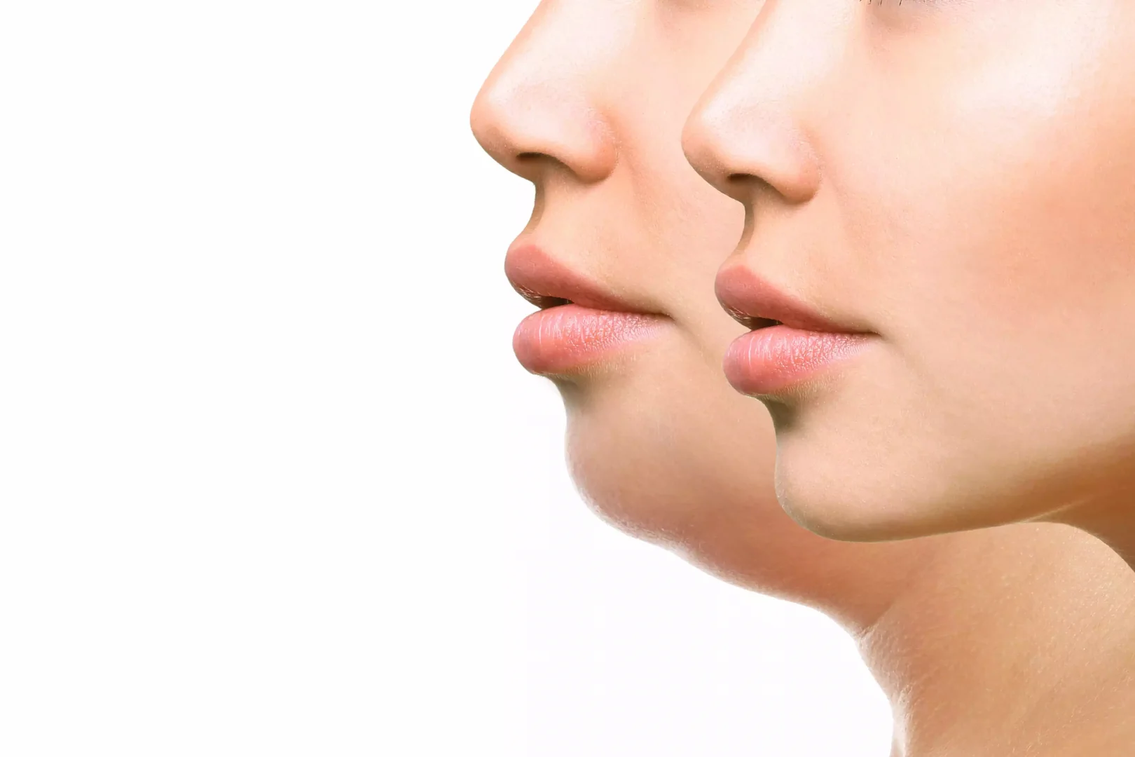 Facial Contouring & Augmentation in Iran