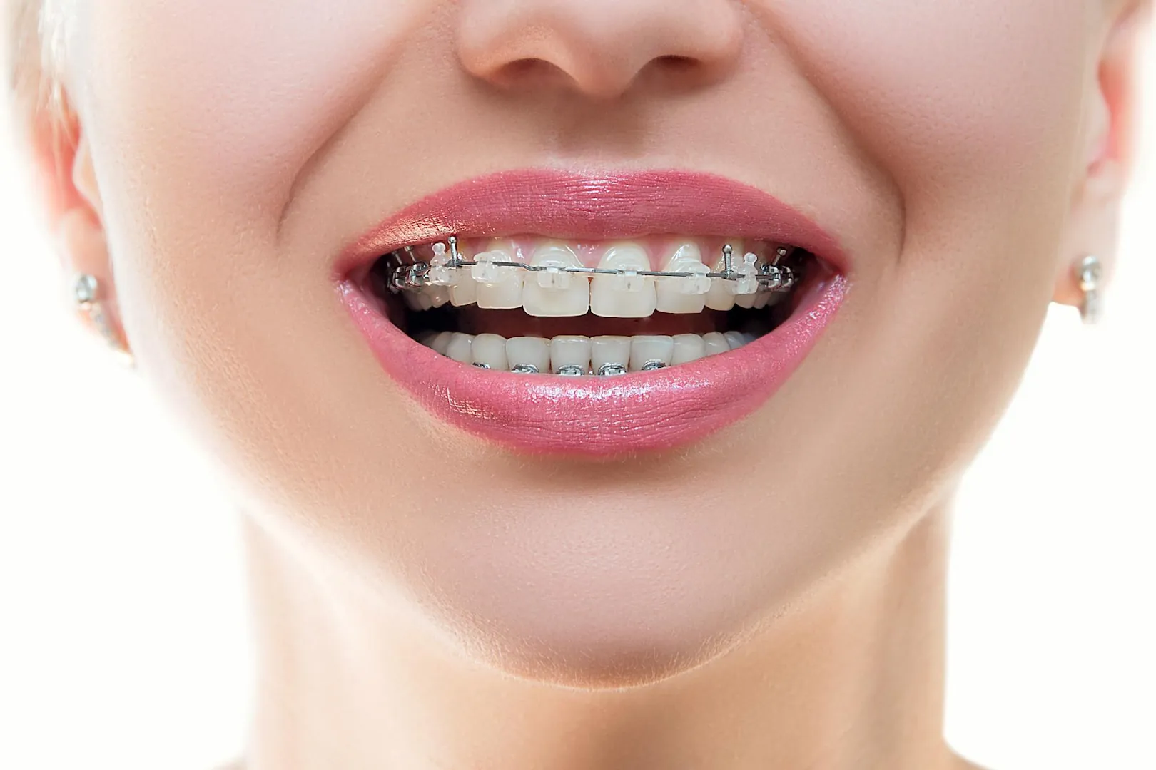 Orthodontics & Foundational Dental Care in Iran