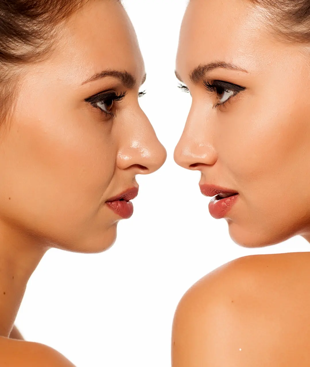Nose job results 5