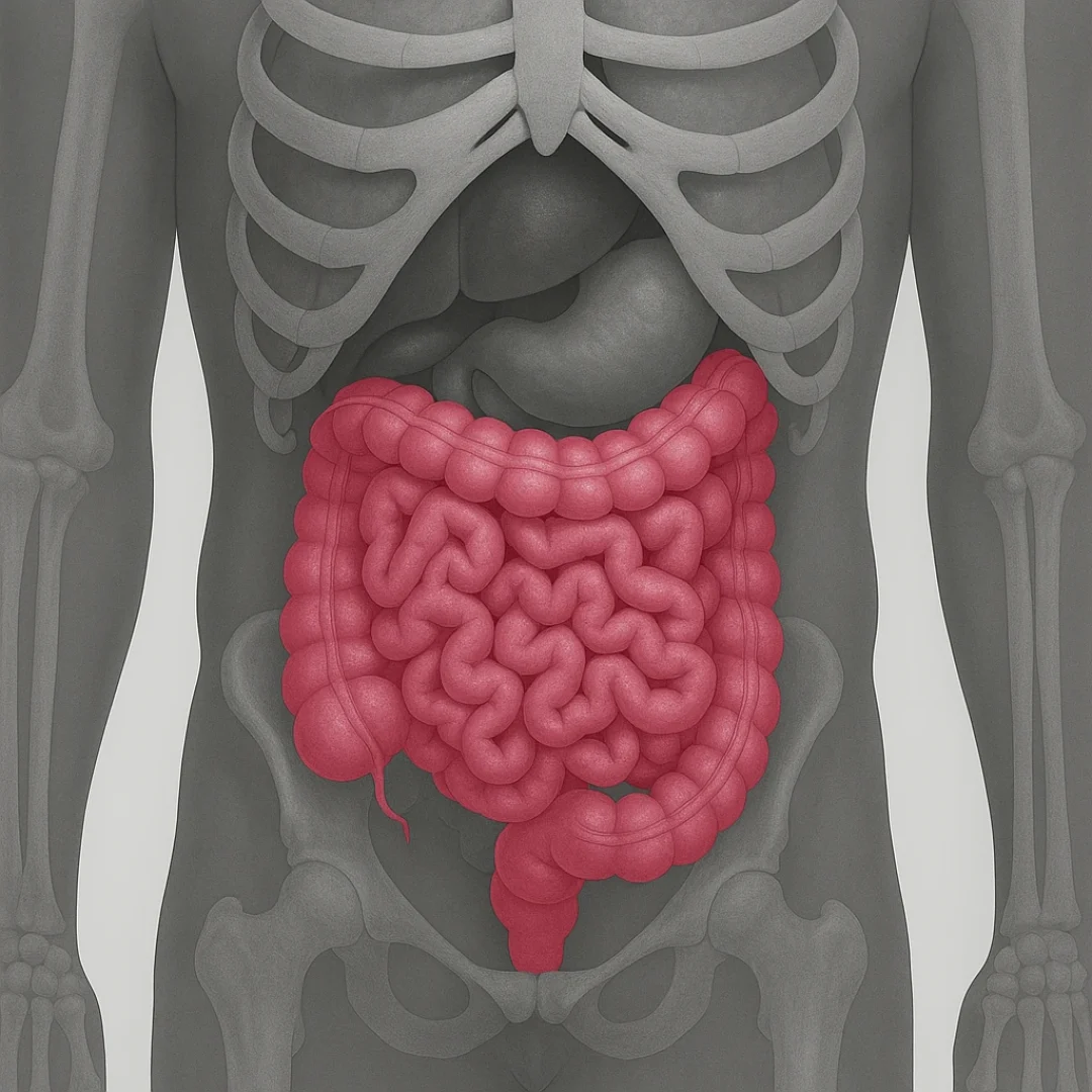 Intestine Transplant in Iran