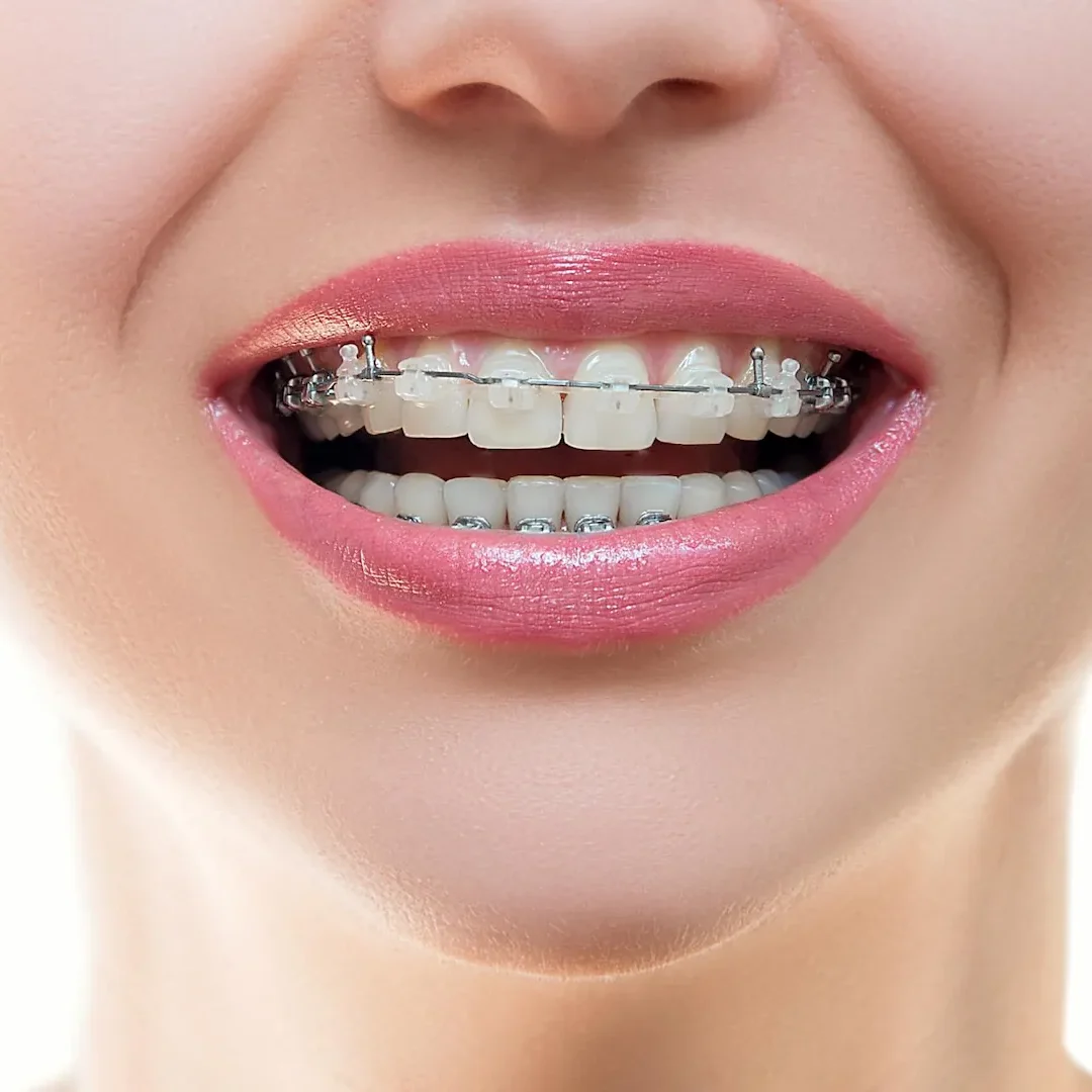 Orthodontics Dental Care