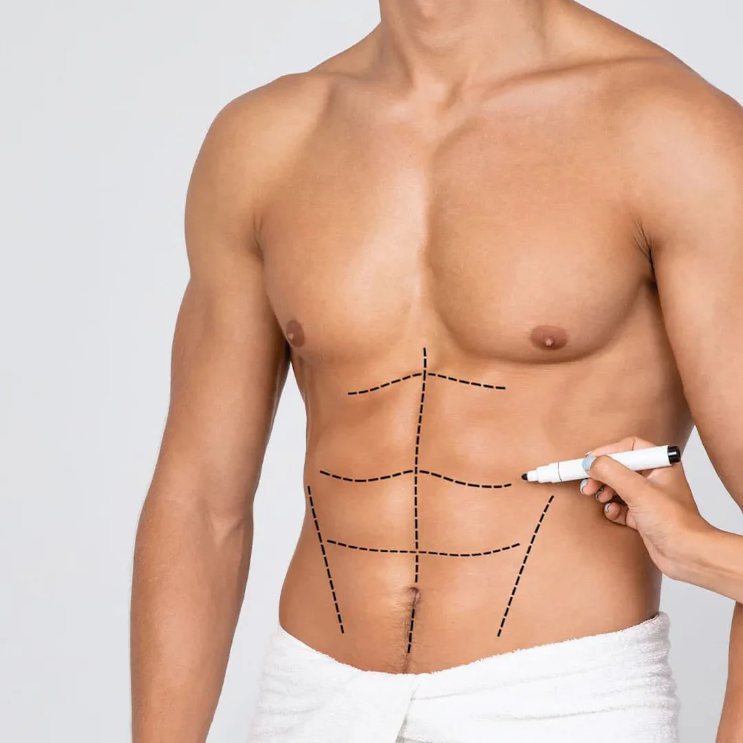 six-pack-surgery